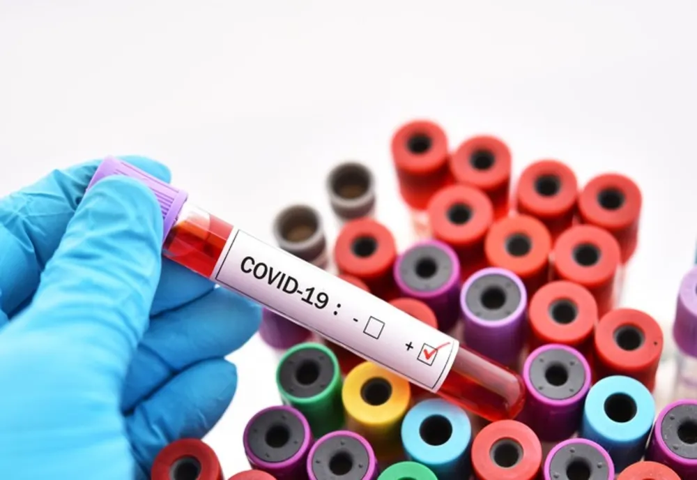 Focar de coronavirus la DSP Ialomița