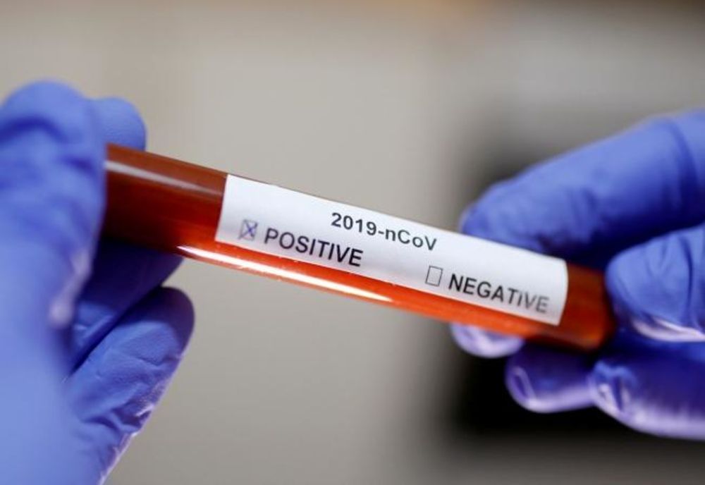 CORONAVIRUS ROMÂNIA - Noul bilanț, anunțat de autorități - 8.746