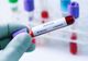 Bilanț coronavirus 7 august: 255 cazuri noi, 8 decese